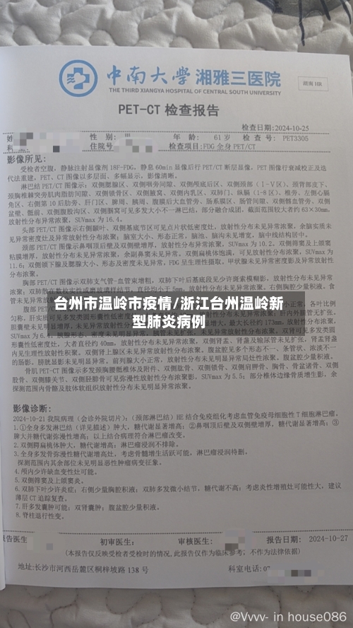 台州市温岭市疫情/浙江台州温岭新型肺炎病例-第1张图片