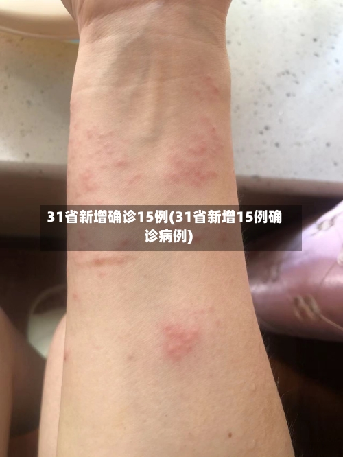 31省新增确诊15例(31省新增15例确诊病例)-第2张图片